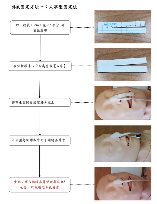 鼻胃管固定方法議題— 中臺科技大學 / 胡月娟講座教授(202602)圖片